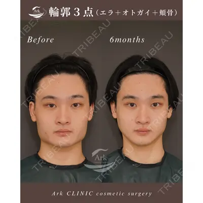 アーククリニック 加藤 雄大医師の症例