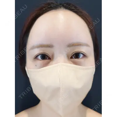 HAAB BEAUTY CLINIC 南青山本院（新院） 小平 佳典医師の症例