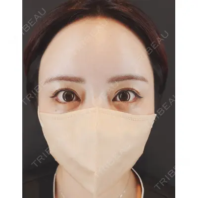 HAAB BEAUTY CLINIC 南青山本院（新院） 小平 佳典医師の症例