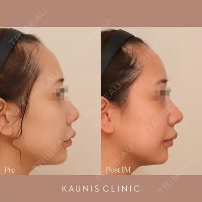 KAUNIS CLINIC（カウニスクリニック）の症例