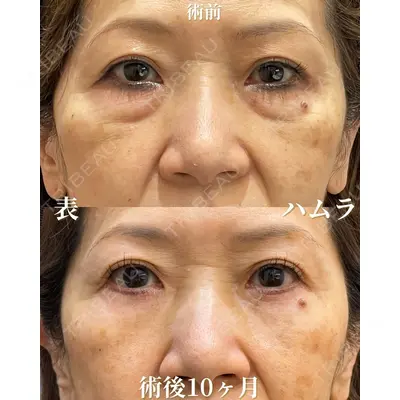 お茶の水美容形成クリニック 吉井 健吾医師の症例