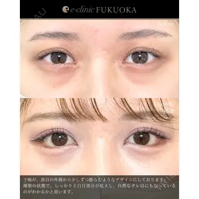 eクリニック 福岡院 伊藤 渉医師の症例