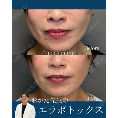ECLA CLINIC (エクラクリニック)の症例