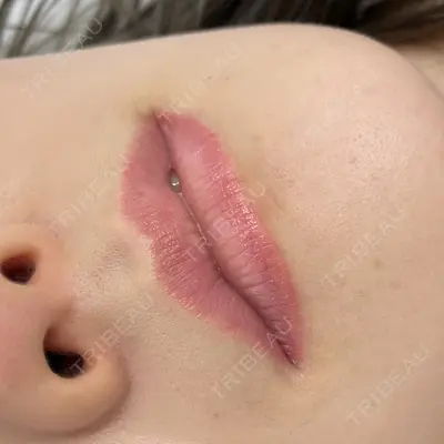 NARU Beauty Clinic 【ナルクリ】 水戸院 地引 輔医師の症例
