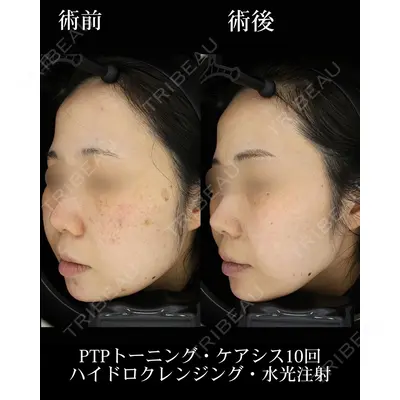 HAAB BEAUTY CLINIC 名古屋院の症例