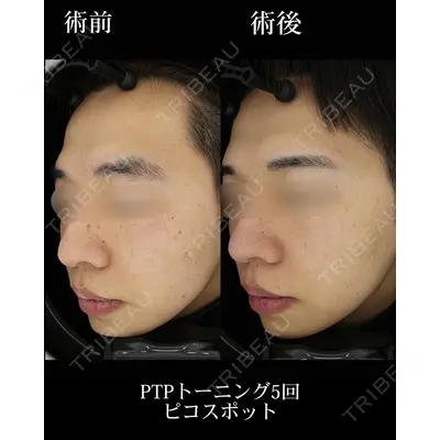 HAAB BEAUTY CLINIC 名古屋院の症例