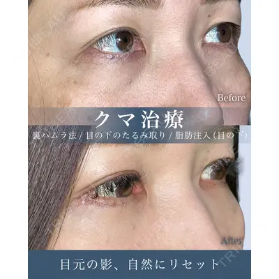 eクリニック 横浜みなとみらい院 坂本 優衣医師の症例
