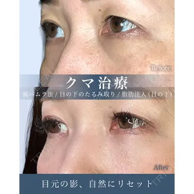 eクリニック 横浜みなとみらい院 坂本 優衣医師の症例