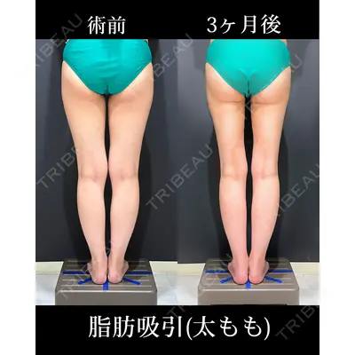 HAAB×DREAM BEAUTY CLINIC 東京本院 吉岡 修一医師の症例