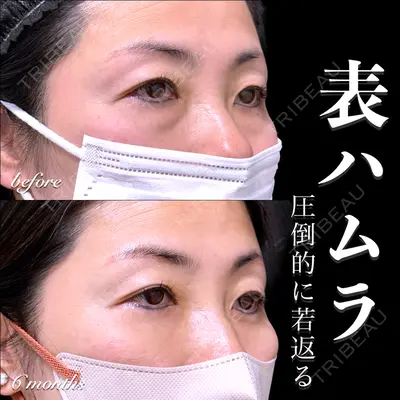 EMMO FACE CLINIC 大宮院 百瀬 直也医師の症例