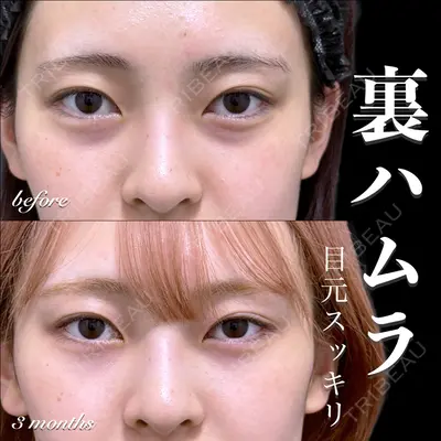 EMMO FACE CLINIC 大宮院 百瀬 直也医師の症例
