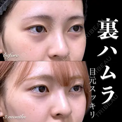 EMMO FACE CLINIC 大宮院 百瀬 直也医師の症例
