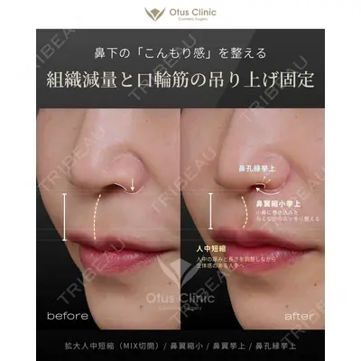 Otus Clinic 【オータスクリニック】 中 徳太郎医師の症例