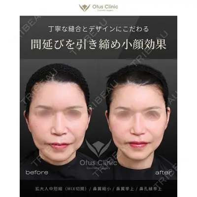 Otus Clinic 【オータスクリニック】 中 徳太郎医師の症例