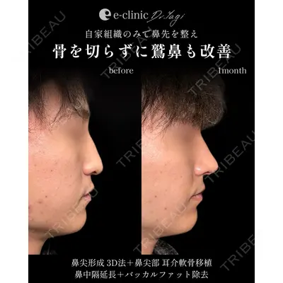 eクリニック 大阪院 八木 良太医師の症例