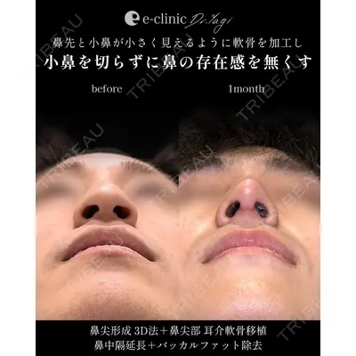 eクリニック 大阪院 八木 良太医師の症例