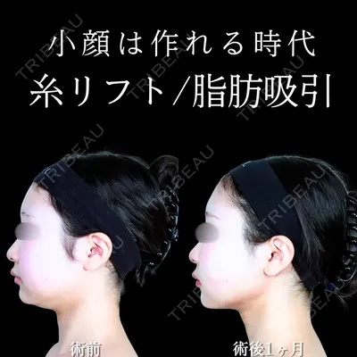 アリエル美容クリニック 水戸院 天白 典秀医師の症例