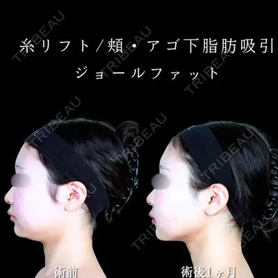 アリエル美容クリニック 水戸院 天白 典秀医師の症例