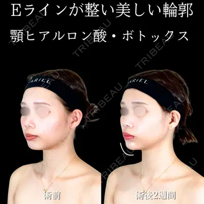 アリエル美容クリニック 横浜院 渡邉 光医師の症例