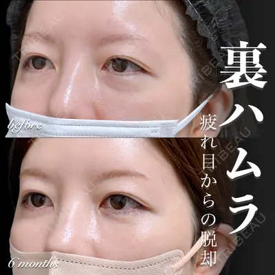 EMMO FACE CLINIC 大宮院 百瀬 直也医師の症例