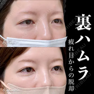 EMMO FACE CLINIC 大宮院 百瀬 直也医師の症例