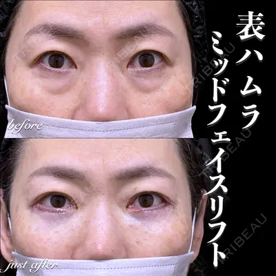 EMMO FACE CLINIC 大宮院 百瀬 直也医師の症例