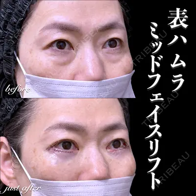 EMMO FACE CLINIC 大宮院 百瀬 直也医師の症例