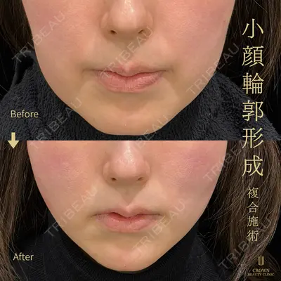 CROWN BEAUTY CLINIC 神山 豊医師の症例