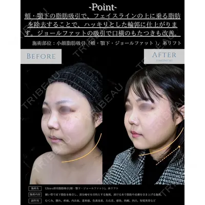 eクリニック 新宿院 相原 隆充医師の症例