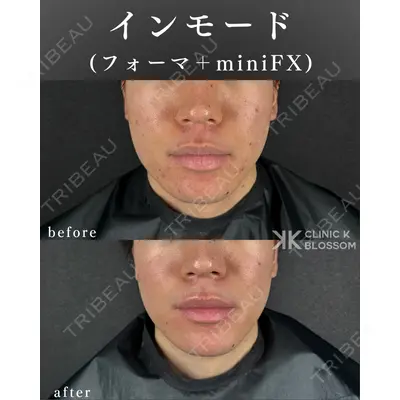 Clinic K Blossomの症例