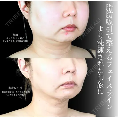 アリエル美容クリニック 横浜院 加藤 敏次医師の症例