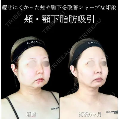 アリエル美容クリニック 横浜院 加藤 敏次医師の症例