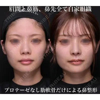 Zetith Beauty Clinic 銀座院 鉄 鑠医師の症例