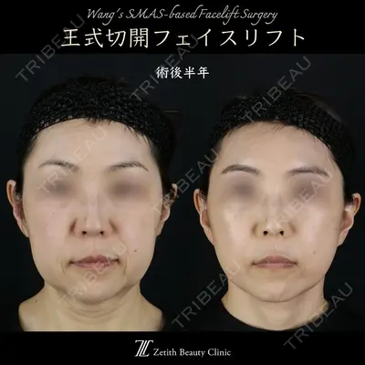 Zetith Beauty Clinic 新宿院 王 蘇医師の症例