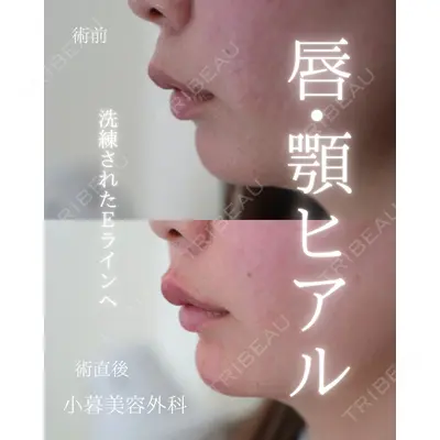 小暮整形外科・美容外科の症例