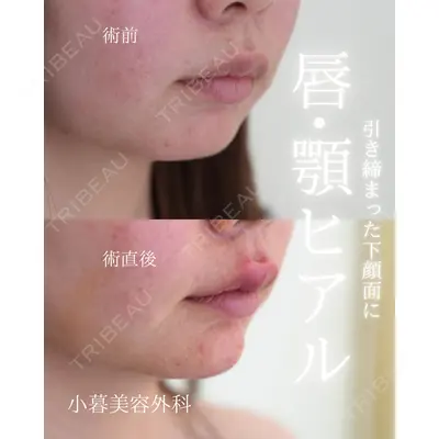 小暮整形外科・美容外科の症例