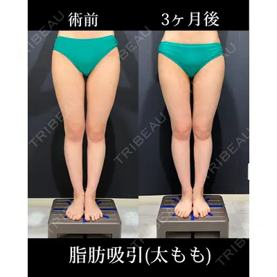 HAAB×DREAM BEAUTY CLINIC 東京本院 吉岡 修一医師の症例