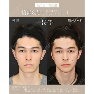KAI CLINIC TOKYO（カイクリニック東京） 髙梨 遼医師の症例