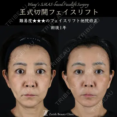 Zetith Beauty Clinic 新宿院 王 蘇医師の症例