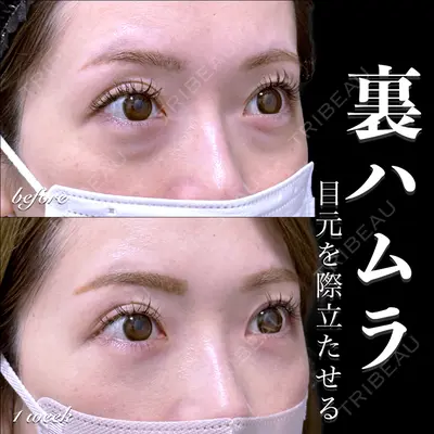 EMMO FACE CLINIC 大宮院 百瀬 直也医師の症例