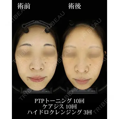 HAAB BEAUTY CLINIC 名古屋院の症例