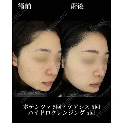 HAAB BEAUTY CLINIC 名古屋院の症例