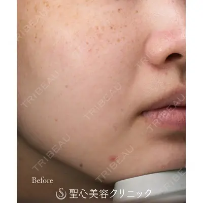 聖心美容クリニック 大阪院 大井 弘一医師の症例