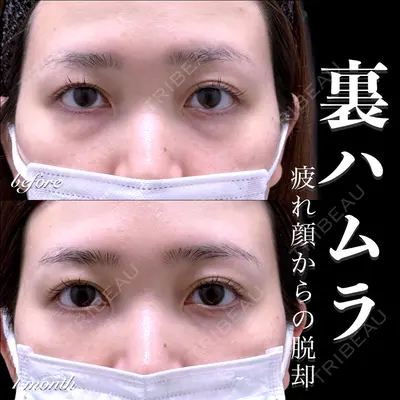 EMMO FACE CLINIC 大宮院 百瀬 直也医師の症例