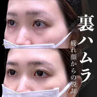 EMMO FACE CLINIC 大宮院 百瀬 直也医師の症例