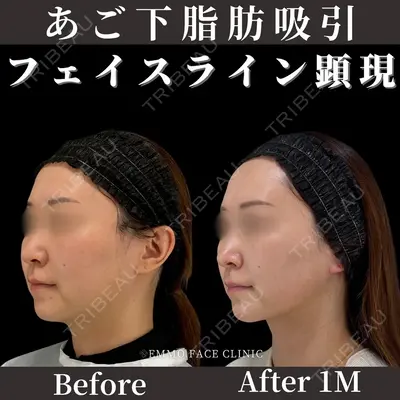 EMMO FACE CLINIC 東京三田院 木之下 哲彦医師の症例
