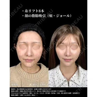 新宿美容外科ネビュラクリニック 山本 紘子医師の症例