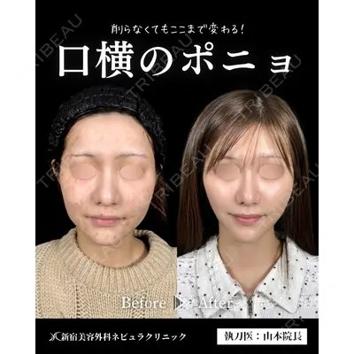 新宿美容外科ネビュラクリニック 山本 紘子医師の症例