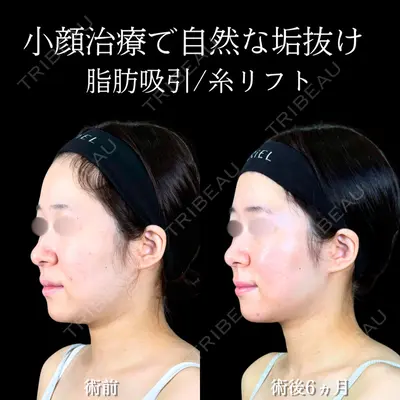 アリエル美容クリニック 大宮院 江郷隼一郎医師の症例