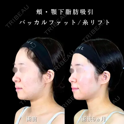 アリエル美容クリニック 大宮院 江郷隼一郎医師の症例